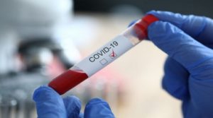 На Рівненщині додалося 67 нових випадків інфікування COVID-19