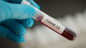 За добу на Рівненщині виявлено понад сотню нових хворих на COVID-19