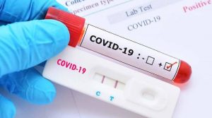На Рівненщині закінчилися експрес-тести на коронавірус: нова партія буде лише через місяць