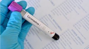Британські науковці назвали новий симптом, який може свідчити про наявність коронавірусу