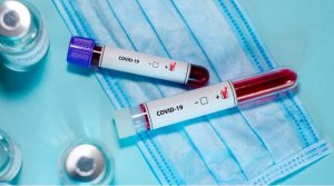 12 наслідків коронавірусу після одужання та як їх позбутися, – пояснення лікаря