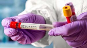 Вчені дослідили, який ризик повторного зараження коронавірусом