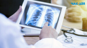 Міфи та факти про туберкульоз: розбираємось з лікарем-фтизіатром